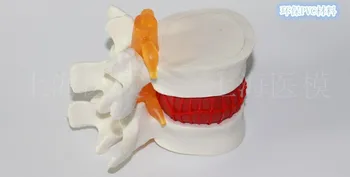 Predstavitveni model ledvenih vretenc hrbtenice model Človeškega ledvenega diska herniation model brezplačna dostava