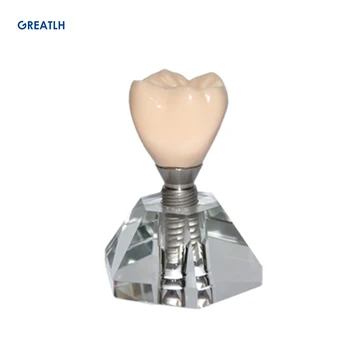 Zobni Model Zob Poučevanja Model Študija Izmenljive Ortodontskega Vsadek Zob Modeli Smolo Zobozdravstvo Zobozdravnik Materiala